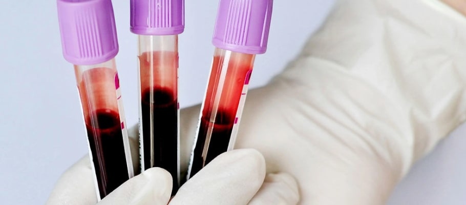 Когда нужно сдавать анализ на свертываемость крови?