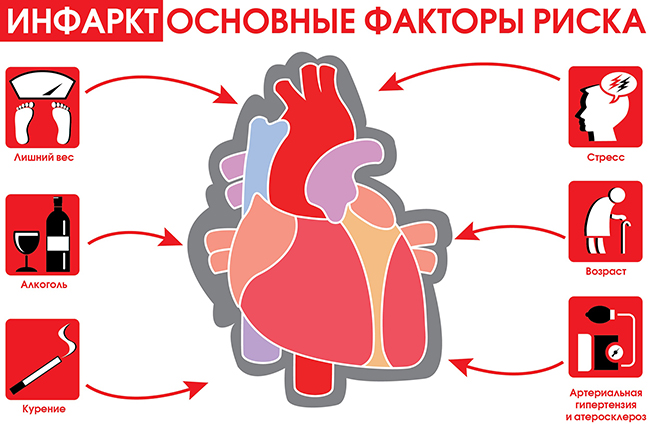 инфаркт, факторы риска